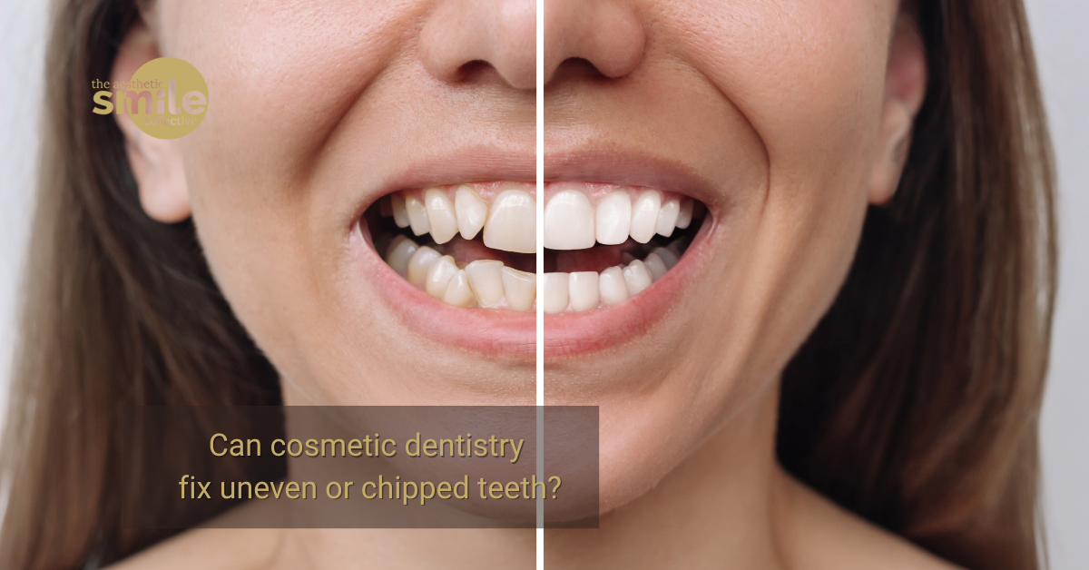 Cosmetic dentist in Brisbane repairing uneven and chipped teeth for a confident smile