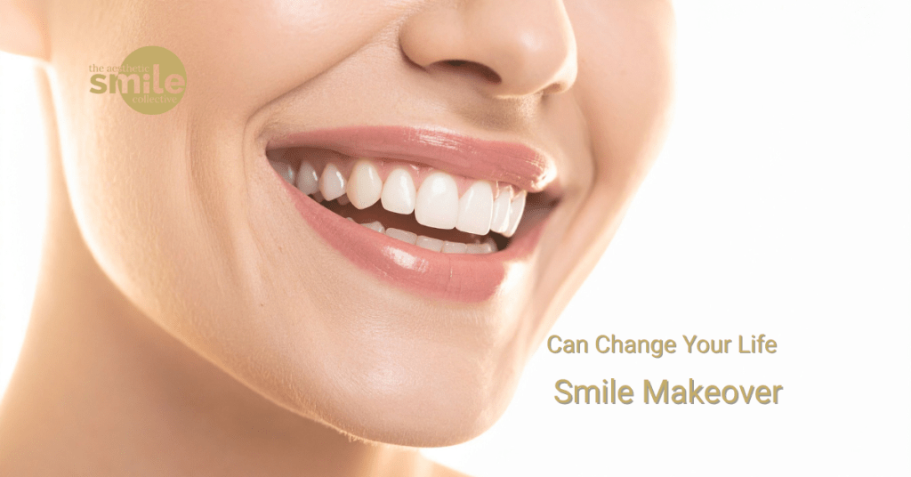Transform your smile with expert smile makeovers in Brisbane at The Aesthetic Smile Collective - personalised cosmetic dentistry that restores confidence and beauty.