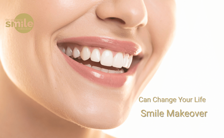  Discover How a Smile Makeover in Brisbane Can Change Your Life