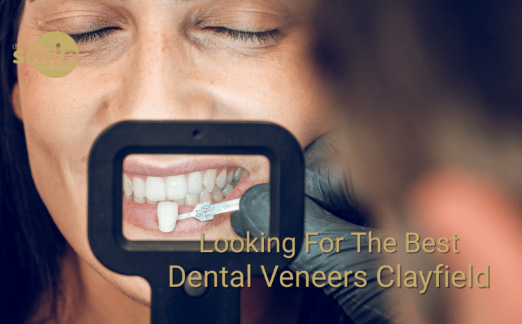  Looking for the Best Dental Veneers in Clayfield?