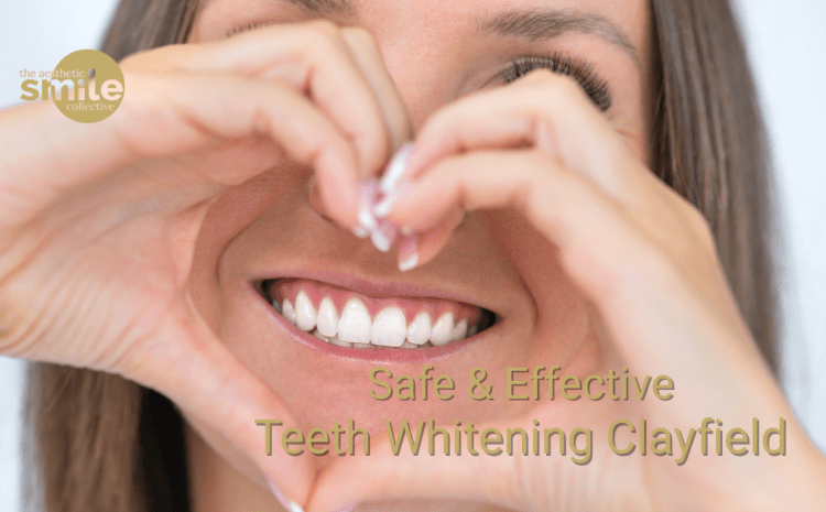  Looking for Safe and Effective Teeth Whitening in Clayfield?