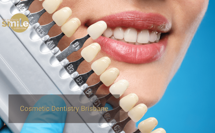  Composite Veneers vs Porcelain Veneers: Your Complete Brisbane Guide to Choosing the Right Smile Upgrade
