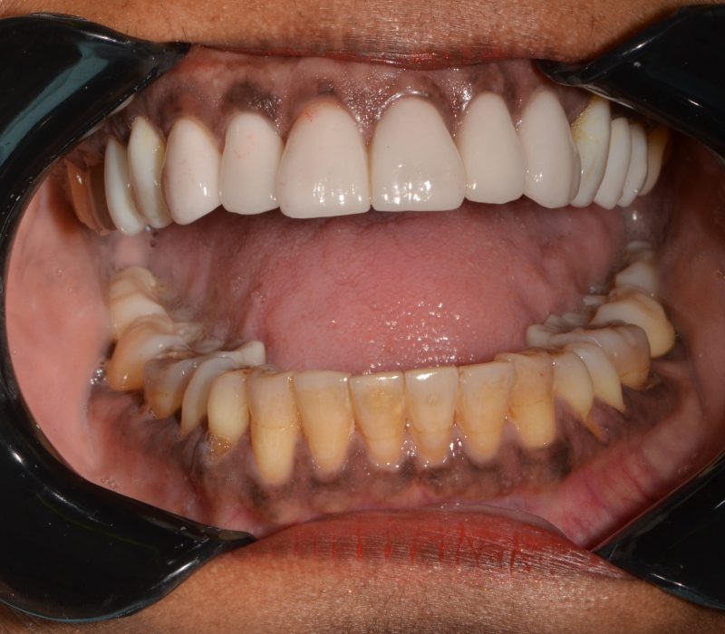 69bb345b3ee408373a62af6d