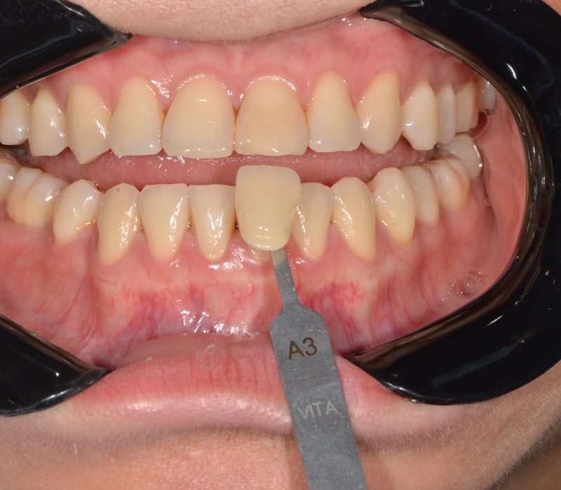 69bb346853d4f11d20b663cb