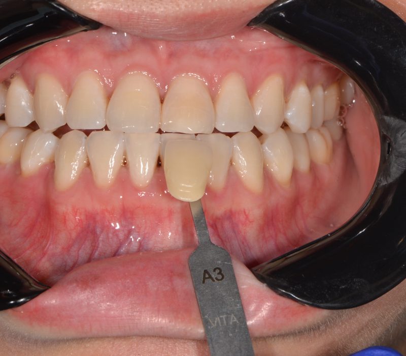 69bb346857109da4b95b9cf5