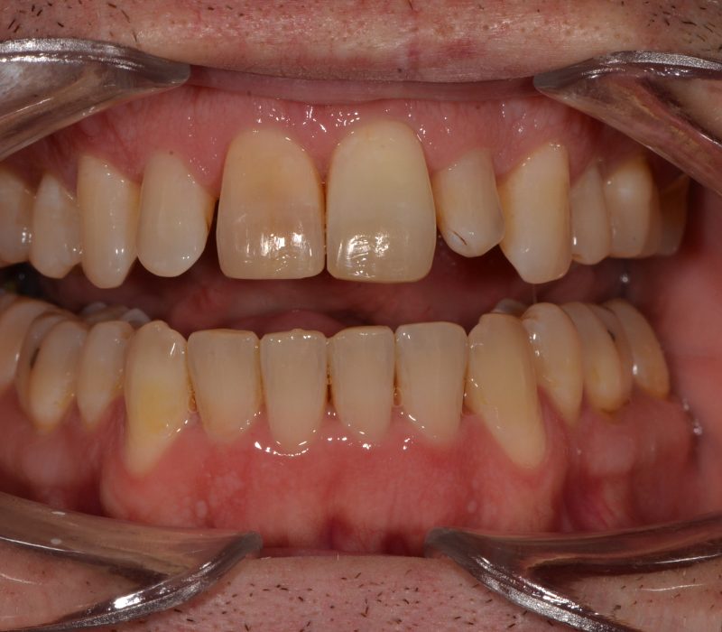 69bb348aaaac0f8392796df9