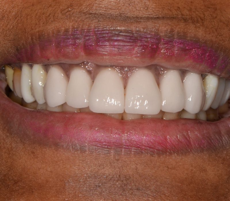 69c2585b3e56b90975ac8e69